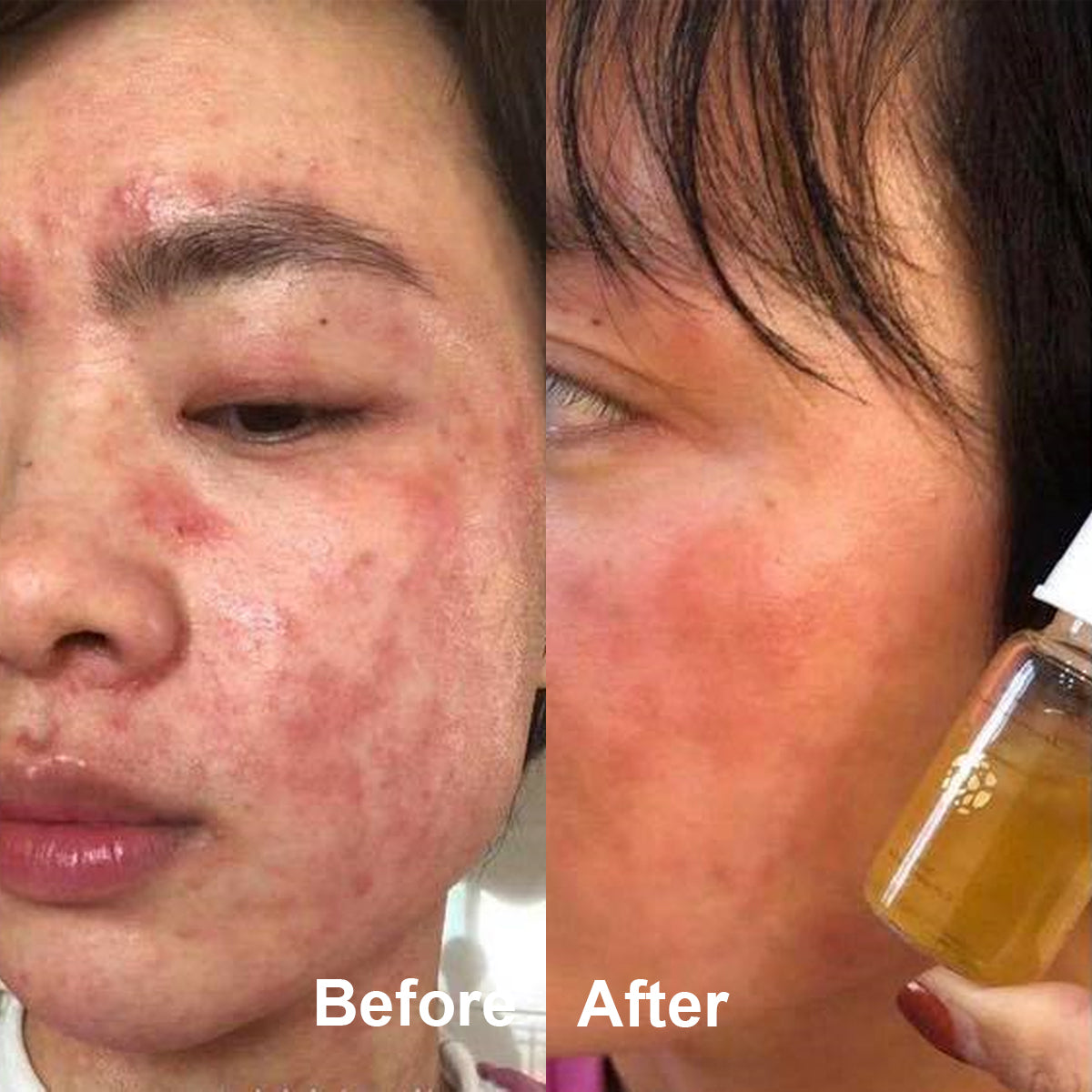 Nimi Premium Essence Human Fat Steam Cell
