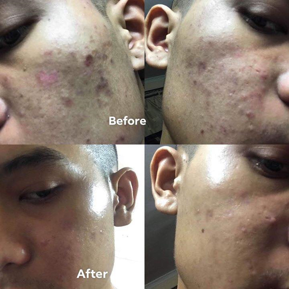 Nimi Premium Essence Human Fat Steam Cell